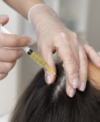 high-angle-woman-getting-scalp-prp-treatment